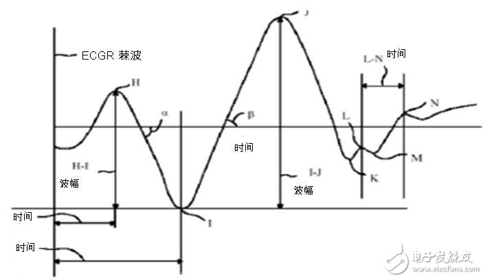 圖二：心臟沖擊掃描圖波形。