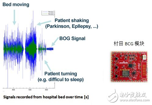 村田智能BCG方案，打造主動健康監測