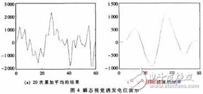 基于FPGA的腦機(jī)接口系統(tǒng)方案