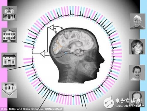 腦電波技術再上一層樓，讀心準確率高達95%